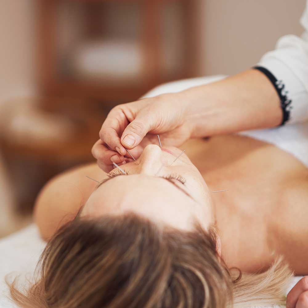 Doğal ve Etkili: Akupunkturun Şifalı Dokunuşu